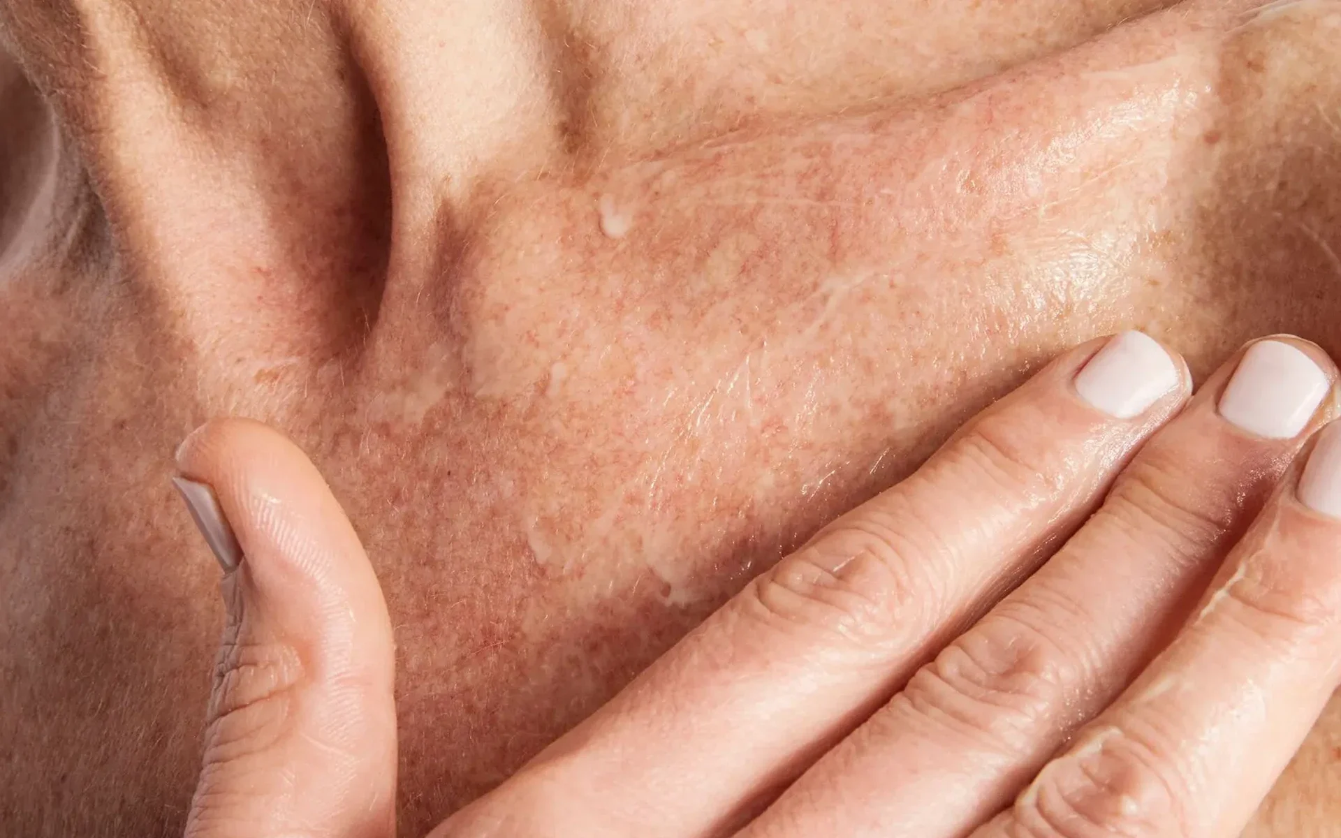 Close-up of dry skin with hand touching